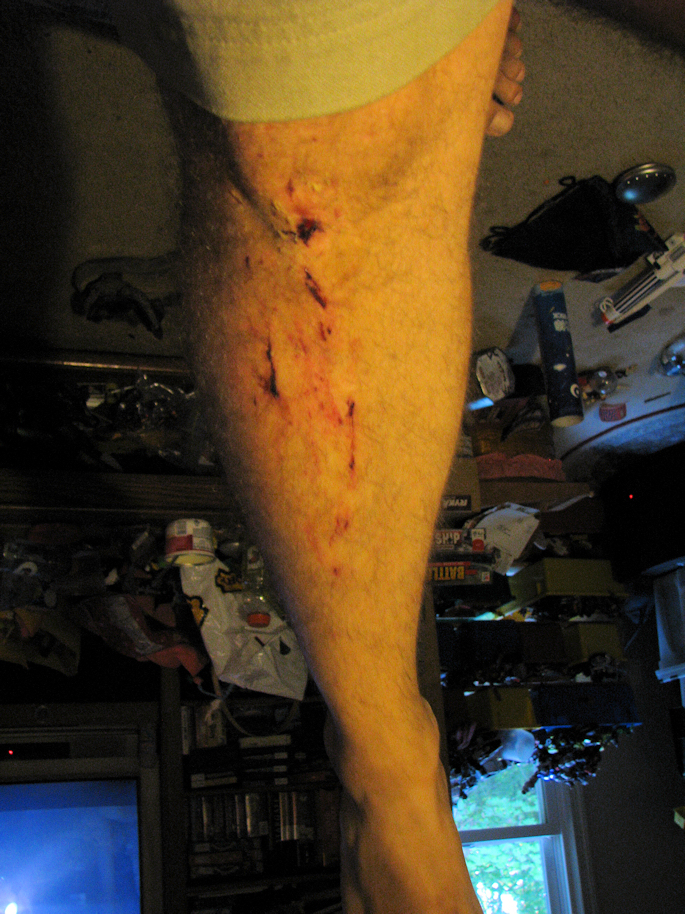2009 Aug 15 Stan Leg